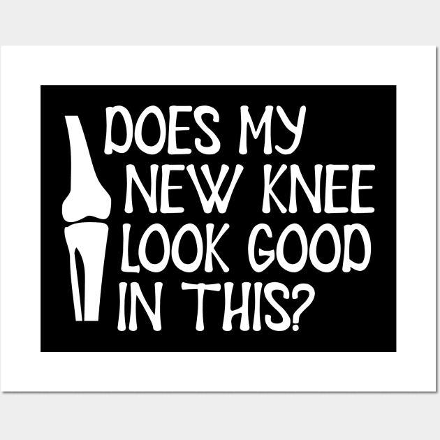 Knee Surgery - Does my new knee look go on this? Wall Art by KC Happy Shop